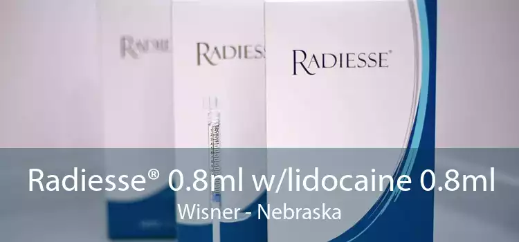 Radiesse® 0.8ml w/lidocaine 0.8ml Wisner - Nebraska